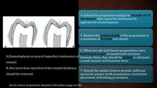 4. Extend the preparation margin to include all of
the fissure that cannot be eliminated by
appropriate enameloplasty
5. Restrict the pulpal depth of the preparation to
a maximum of 0.2 mm into dentin
6. When two pit-and-fissure preparations have
less than 0.5 mm of sound tooth structure
between them, they should be joined to eliminate
a weak enamel wall between them.
7. Extend the outline form to provide sufficient
access for proper tooth preparation, restoration
placement, & finishing procedures
A,Enameloplasty on area of imperfect coalescence of
enamel.
B, Not more than onet hird of the enamel thickness
should be removed.
Art & science of operative dentistry 5th edition page no.301
 
