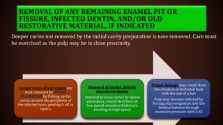 Larger areas of soft caries are
best removed by SPOON
EXCAVATERS by flaking up the
caries around the periphery of
the infected mass peeling it off in
layers.
Removal of harder, heavily
discolored dentin
removal process varies by spoon
excavaters, round steel burs at
low speed, round carbide burs
rotating at high speed
Pulpal damage may result from
the creation of frictional heat
with the use of a bur.
Pulp may become infected by
forcing microorganism into the
dentnal tubules through
excessive pressure with a SE
Deeper caries not removed by the initial cavity preparation is now removed. Care must
be exercised as the pulp may be in close proximity.
REMOVAL OF ANY REMAINING ENAMEL PIT OR
FISSURE, INFECTED DENTIN, AND/OR OLD
RESTORATIVE MATERIAL, IF INDICATED
 