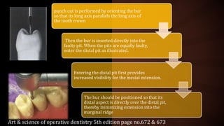 punch cut is performed by orienting the bur
so that its long axis parallels the long axis of
the tooth crown
Then the bur is inserted directly into the
faulty pit. When the pits are equally faulty,
enter the distal pit as illustrated.
Entering the distal pit first provides
increased visibility for the mesial extension.
The bur should be positioned so that its
distal aspect is directly over the distal pit,
thereby minimizing extension into the
marginal ridge
Art & science of operative dentistry 5th edition page no.672 & 673
 