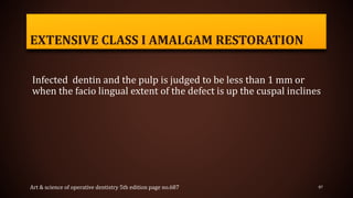 EXTENSIVE CLASS I AMALGAM RESTORATION
Infected dentin and the pulp is judged to be less than 1 mm or
when the facio lingual extent of the defect is up the cuspal inclines
87Art & science of operative dentistry 5th edition page no.687
 
