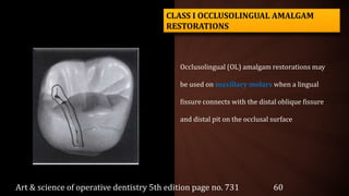 Occlusolingual (OL) amalgam restorations may
be used on maxillary molars when a lingual
fissure connects with the distal oblique fissure
and distal pit on the occlusal surface
CLASS I OCCLUSOLINGUAL AMALGAM
RESTORATIONS
Art & science of operative dentistry 5th edition page no. 731 60
 