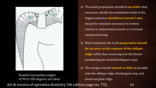  The tooth preparation should be no wider than
necessary; ideally the mesiodistal width of the
lingual extension should not exceed 1 mm,
except for extension necessary to remove
carious or undermined enamel or to include
unusual fissuring.
 When indicated, the tooth preparation should
be cut more at the expense of the oblique
ridge rather than centering over the fissure
(weakening the small distolingual cusp).
 The margins should extend as little as possible
onto the oblique ridge, distolingual cusp, and
distal marginal ridge.
Enamel cavosurface angles
of 90 to 100 degrees are ideal.
Art & science of operative dentistry 5th edition page no. 732 61
 