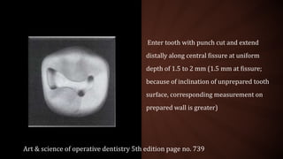 Enter tooth with punch cut and extend
distally along central fissure at uniform
depth of 1.5 to 2 mm (1.5 mm at fissure;
because of inclination of unprepared tooth
surface, corresponding measurement on
prepared wall is greater)
Art & science of operative dentistry 5th edition page no. 739
 