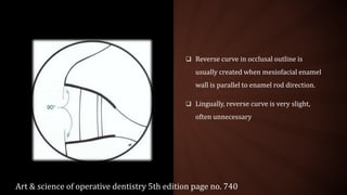  Reverse curve in occlusal outline is
usually created when mesiofacial enamel
wall is parallel to enamel rod direction.
 Lingually, reverse curve is very slight,
often unnecessary
Art & science of operative dentistry 5th edition page no. 740
 