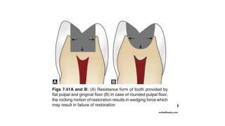 steps of cavity preparation in conservative dentistry | PPTX