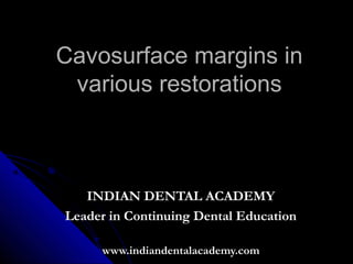Cavosurface margins in
 various restorations



   INDIAN DENTAL ACADEMY
Leader in Continuing Dental Education

     www.indiandentalacademy.com
 