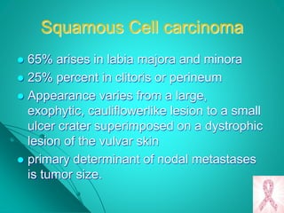 Squamous Cell carcinoma
 65% arises in labia majora and minora
 25% percent in clitoris or perineum
 Appearance varies from a large,
exophytic, cauliflowerlike lesion to a small
ulcer crater superimposed on a dystrophic
lesion of the vulvar skin
 primary determinant of nodal metastases
is tumor size.
 