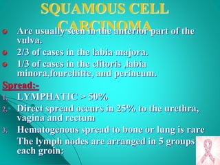 SQUAMOUS CELL
CARCINOMAAre usually seen in the anterior part of the
vulva.
2/3 of cases in the labia majora.
1/3 of cases in the clitoris ,labia
minora,fourchitte, and perineum.
Spread:-
1. LYMPHATIC > 50%
2. Direct spread occurs in 25% to the urethra,
vagina and rectum
3. Hematogenous spread to bone or lung is rare
The lymph nodes are arranged in 5 groups in
each groin:
 