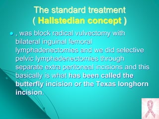 The standard treatment
( Hallstedian concept )
 , was block radical vulvectomy with
bilateral inguinal femoral
lymphadenectomies and we did selective
pelvic lymphadenectomies through
separate extra peritoneal incisions and this
basically is what has been called the
butterfly incision or the Texas longhorn
incision.
 