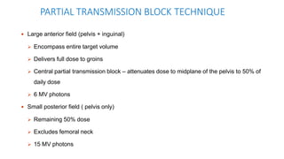 PARTIAL TRANSMISSION BLOCK TECHNIQUE
 Large anterior field (pelvis + inguinal)
 Encompass entire target volume
 Delivers full dose to groins
 Central partial transmission block – attenuates dose to midplane of the pelvis to 50% of
daily dose
 6 MV photons
 Small posterior field ( pelvis only)
 Remaining 50% dose
 Excludes femoral neck
 15 MV photons
 