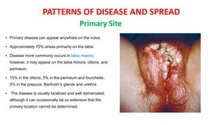 PATTERNS OF DISEASE AND SPREAD
• Primary disease can appear anywhere on the vulva.
• Approximately 70% arises primarily on the labia.
• Disease more commonly occurs in labia majora;
however, it may appear on the labia minora, clitoris, and
perineum.
• 15% in the clitoris, 5% in the perineum and fourchette,
5% in the prepuce, Bartholin's glands and urethra
• The disease is usually localized and well demarcated;
although it can occasionally be so extensive that the
primary location cannot be determined.
Primary Site
 