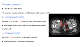 1. VAGINAL INVOLVEMENT:
• Gross d/s plus 3 cm in CTV.
• If uncertain of proximal extent or LVSI include entire vagina in CTV
2. URETHRAL INVOLVEMENT:
• Include gross d/s plus 2 cm of urethra for periurethral lesion.
•Entire urethra and bladder neck included if extensive urethral
involvement
3. ANAL INVOLVEMENT:
•Include a 1–2 cm margin if anal verge is involved
•Entire mesorectum if anal canal involvement
 