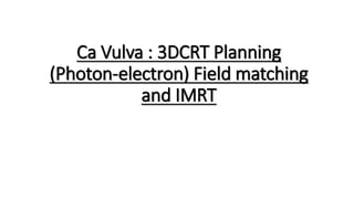 Ca Vulva : 3DCRT Planning
(Photon-electron) Field matching
and IMRT
 