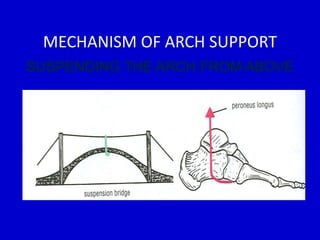 MECHANISM OF ARCH SUPPORT
SUSPENDING THE ARCH FROM ABOVE
 