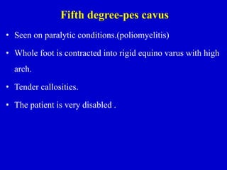 Fifth degree-pes cavus
• Seen on paralytic conditions.(poliomyelitis)
• Whole foot is contracted into rigid equino varus with high
arch.
• Tender callosities.
• The patient is very disabled .
 