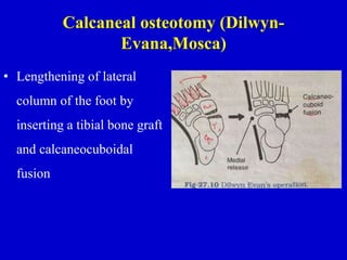 Calcaneal osteotomy (Dilwyn-
Evana,Mosca)
• Lengthening of lateral
column of the foot by
inserting a tibial bone graft
and calcaneocuboidal
fusion
 