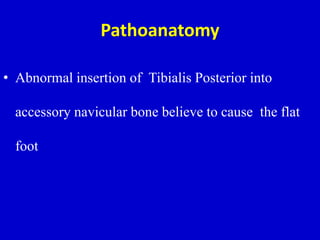 Pathoanatomy
• Abnormal insertion of Tibialis Posterior into
accessory navicular bone believe to cause the flat
foot
 