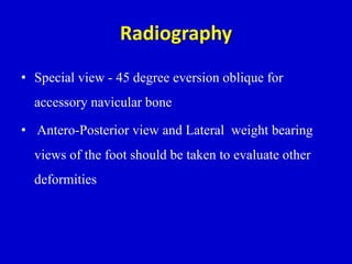 Radiography
• Special view - 45 degree eversion oblique for
accessory navicular bone
• Antero-Posterior view and Lateral weight bearing
views of the foot should be taken to evaluate other
deformities
 