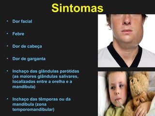 Sintomas 
• Dor facial 
• Febre 
• Dor de cabeça 
• Dor de garganta 
• Inchaço das glândulas parótidas 
(as maiores glândulas salivares, 
localizadas entre a orelha e a 
mandíbula) 
• Inchaço das têmporas ou da 
mandíbula (zona 
temporomandibular) 
 