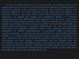 2. Paciente do sexo masculino, 23 anos de idade, caucasiano, estava com 
queixa principal de inchaço e dor na região da glândula parótida direita. A 
anamnese revelou uma condição saudável, sem nenhuma história de 
doença sistêmica, sem fazer qualquer uso de medicação ou drogas e o 
paciente informou que duas noites antes, tinha começado a sentir dor à 
palpação na região de ângulo da mandíbula direita e o mesmo 
apresentava-se com dificuldade para abertura total da boca. Não havia 
história de trauma direto na área. A dor intensa associada com o inchaço na 
região e a presença de trismo levou o paciente a procura do tratamento. Ao 
exame físico extra-oral o paciente apresentava- se com um aumento 
eritematoso da glândula parótida direita, com ausência de linfonodos 
infartados na cadeia submandibular, a bochecha estava endurecida, 
quente e inchada e a função do nervo facial estava normal bilateralmente 
(Figura. 1). O exame intra-oral demonstrou que o paciente apresentava-se 
com obstrução do ducto da glândula parótida, evidenciado por meio da 
diminuição do fluxo salivar, caracterizado por um quadro leve de 
xerostomia, com uma boa higiene oral e com ausencia de descarga de pus 
por meio do ducto de Stensen. Resultados do hemograma para contagem 
de leucócitos e plaquetas demonstraram valores normais assim como para 
hemoglobina 15,9 g / dL e hematócrito 47,6%. 
 