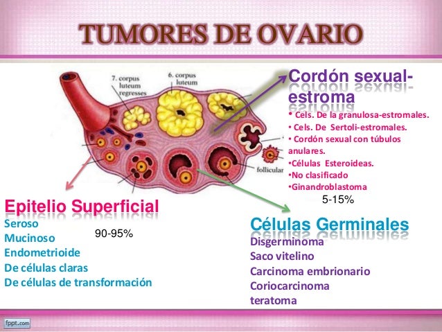 Quitar un ovario consecuencias