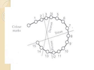 Color Vision Test and interpretation in human eye | PPTX