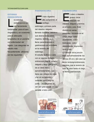 TATIANA BARTOLOSAN JUAN
04/04/2017
ESTUDIOS
ENDOSCÓPICOS
os estudios
endoscópicos son
una herramienta
fundamental para el buen
diagnóstico y en ocasiones
para la adecuada
terapéutica de un paciente
con enfermedad del
hígado. Las categorías de
estudio más
frecuentemente utilizadas
son las siguientes:
PANENDOSCOPIA
l tubo digestivo
alto comprende al
esófago,
estómago y primera parte
del intestino delgado,
llamada duodeno; debido a
que abarca todos estos
órganos, también se le
llama panendoscopia o
gastroscopia por el énfasis
en la revisión del
estómago.
El estudio se lleva a cabo
con un aparato llamada
endoscopio que es un tubo
delgado y largo (del grosor
de un dedo índice
aproximadamente), que
tiene una cámara de video
y luz en su extremo y
controles para dirigir la
punta. Las imágenes se
ven con gran detalle en una
pantalla a todo color.
COLONOSCOPIA
l colon o intestino
grueso inicia
después del
intestino delgado y termina
en el recto y ano. Está
dividido en varias
porciones, iniciando en el
ciego, luego colon
ascendente, colon
transverso, colon
descendente, sigmoides,
recto y ano.
La revisión de la porción
final (aproximadamente los
últimos 25 cm.) del colon se
llama rectosigmoidoscopia,
mientras que la revisión de
todo el colon hasta el ciego,
se llama colonoscopía.
L E E
panendoscopia colonoscopia
Ilustración 6
 