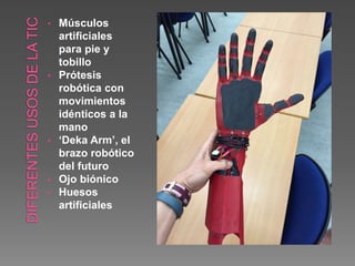 • Músculos
artificiales
para pie y
tobillo
• Prótesis
robótica con
movimientos
idénticos a la
mano
• ‘Deka Arm’, el
brazo robótico
del futuro
• Ojo biónico
• Huesos
artificiales
 