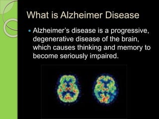What is Alzheimer Disease
 Alzheimer’s disease is a progressive,
degenerative disease of the brain,
which causes thinking and memory to
become seriously impaired.
 