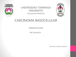 UNIVERSIDAD TOMINAGA
NAKAMOTO
Escuela de Medicina
CARCINOMA BASOCELULAR
DERMATOLOGÍA
6to Semestre
Sandoval Campos Andrea C.
 