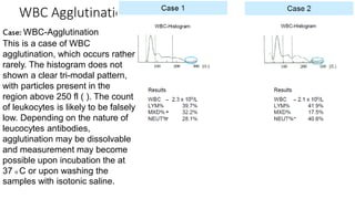 WBC Agglutination
Case: WBC-Agglutination
This is a case of WBC
agglutination, which occurs rather
rarely. The histogram does not
shown a clear tri-modal pattern,
with particles present in the
region above 250 fl ( ). The count
of leukocytes is likely to be falsely
low. Depending on the nature of
leucocytes antibodies,
agglutination may be dissolvable
and measurement may become
possible upon incubation the at
37 o C or upon washing the
samples with isotonic saline.
 