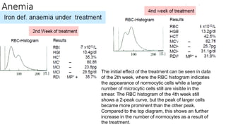 Anemia
The initial effect of the treatment can be seen in data
of the 2th week, where the RBC histogram indicates
the appearance of normocytic cells while a large
number of microcytic cells still are visible in the
smear. The RBC histogram of the 4th week still
shows a 2-peak curve, but the peak of larger cells
became more prominent than the other peak.
Compared to the top diagram, this shows an further
increase in the number of normocytes as a result of
the treatment.
 
