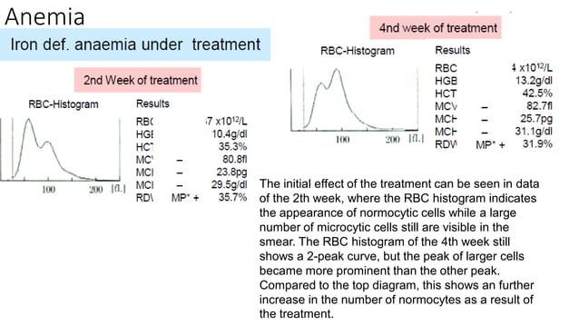 cbc histogram.pdf