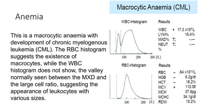 cbc histogram.pdf | Blood Disorders | Diseases and Conditions