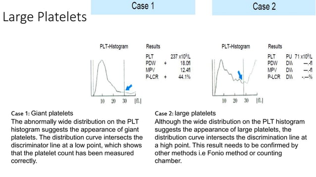 cbc histogram.pdf