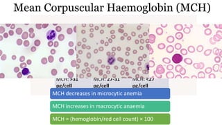 Mean Corpuscular Haemoglobin (MCH)
MCH decreases in microcytic anemia
MCH increases in macrocytic anaemia
MCH = (hemoglobin/red cell count) × 100
 