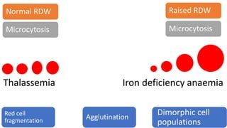 Thalassemia Iron deficiency anaemia
Normal RDW
Microcytosis
Raised RDW
Microcytosis
Red cell
fragmentation Agglutination
Dimorphic cell
populations
 