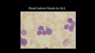 Hand mirror blasts in ALL
 