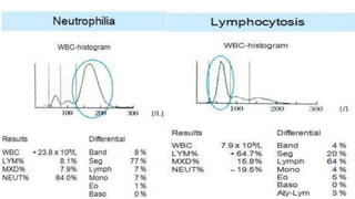 Complete blood count INTERPRETATION on SYSMEX.pdf