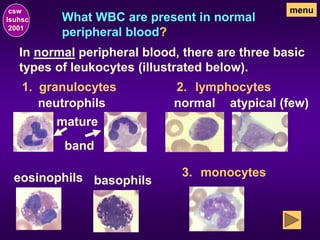 What WBC are present in normal
peripheral blood?
csw
lsuhsc
2001
menu
1. granulocytes
In normal peripheral blood, there are three basic
types of leukocytes (illustrated below).
monocytes
3.
eosinophils basophils
neutrophils
lymphocytes
2.
normal atypical (few)
mature
band
 