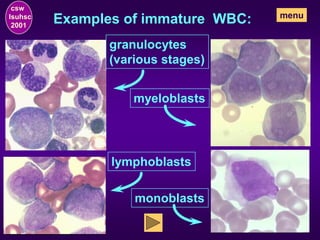 Examples of immature WBC:
granulocytes
(various stages)
myeloblasts
lymphoblasts
monoblasts
csw
lsuhsc
2001
menu
 
