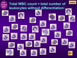 Total WBC count = total number of
leukocytes without differentiation:
csw
lsuhsc
2001
menu
 