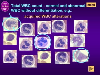 Total WBC count - normal and abnormal
WBC without differentiation, e.g.:
csw
lsuhsc
2001
menu
acquired WBC alterations
 