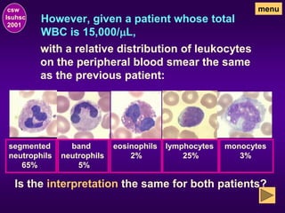 However, given a patient whose total
WBC is 15,000/mL,
csw
lsuhsc
2001
menu
with a relative distribution of leukocytes
on the peripheral blood smear the same
as the previous patient:
segmented
neutrophils
65%
band
neutrophils
5%
eosinophils
2%
lymphocytes
25%
monocytes
3%
Is the interpretation the same for both patients?
 