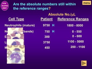 Are the absolute numbers still within
the reference ranges?
csw
lsuhsc
2001
menu
Neutrophils (mature)
Neutrophils (bands)
Eosinophils
Lymphocytes
Monocytes
Cell Type Patient Reference Ranges
Absolute No./mL
1800 - 8000
9750
0 - 550
750
0 - 600
300
1100 - 5000
3750
200 - 1100
450
H
H
 