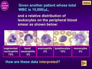 Given another patient whose total
WBC is 15,000/mL,
csw
lsuhsc
2001
menu
and a relative distribution of
leukocytes on the peripheral blood
smear as shown below:
segmented
neutrophils
75%
band
neutrophils
5%
eosinophils
2%
lymphocytes
15%
monocytes
3%
How are these data interpreted?
 