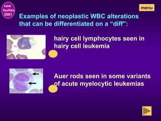 Examples of neoplastic WBC alterations
that can be differentiated on a “diff”:
hairy cell lymphocytes seen in
hairy cell leukemia
Auer rods seen in some variants
of acute myelocytic leukemias
csw
lsuhsc
2001
menu
 