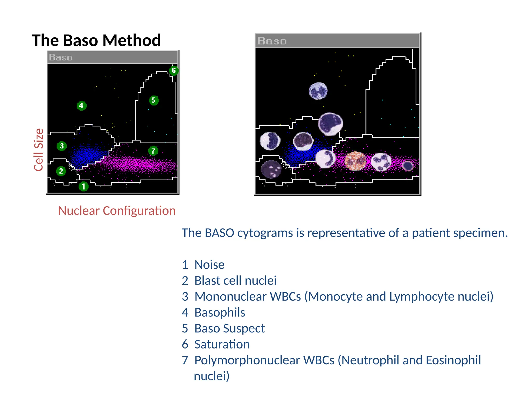 CBC, Principle of Cell Counter, Interpretation of Histogram ...