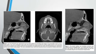 Cbct | PPTX