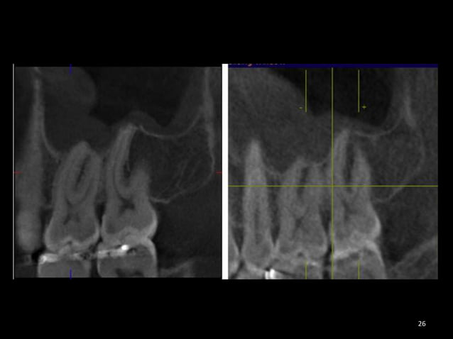 Cbct | PPTX